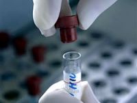 HIV tedavisi bulaşmayı önlüyor